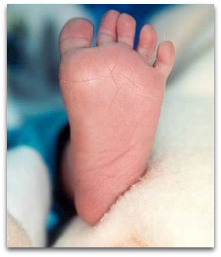 baby toes